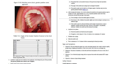 دانلود پی دی اف کتاب بی حسی موضعی در دندانپزشکی انتشارات رویان پژوه PDF