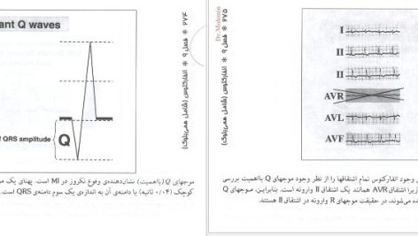 دانلود پی دی اف کتاب خواندن فوری الکتروکاردیوگرام دیل دوبین PDF